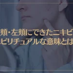右頬・左頬にできたニキビのスピリチュアルな意味とは？