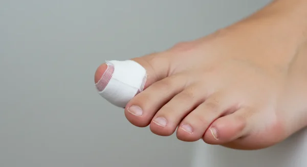 爪が剥がれる夢の意味とは？