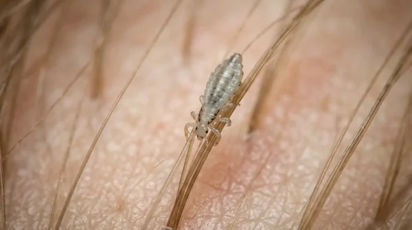 寄生虫の夢の意味とは？